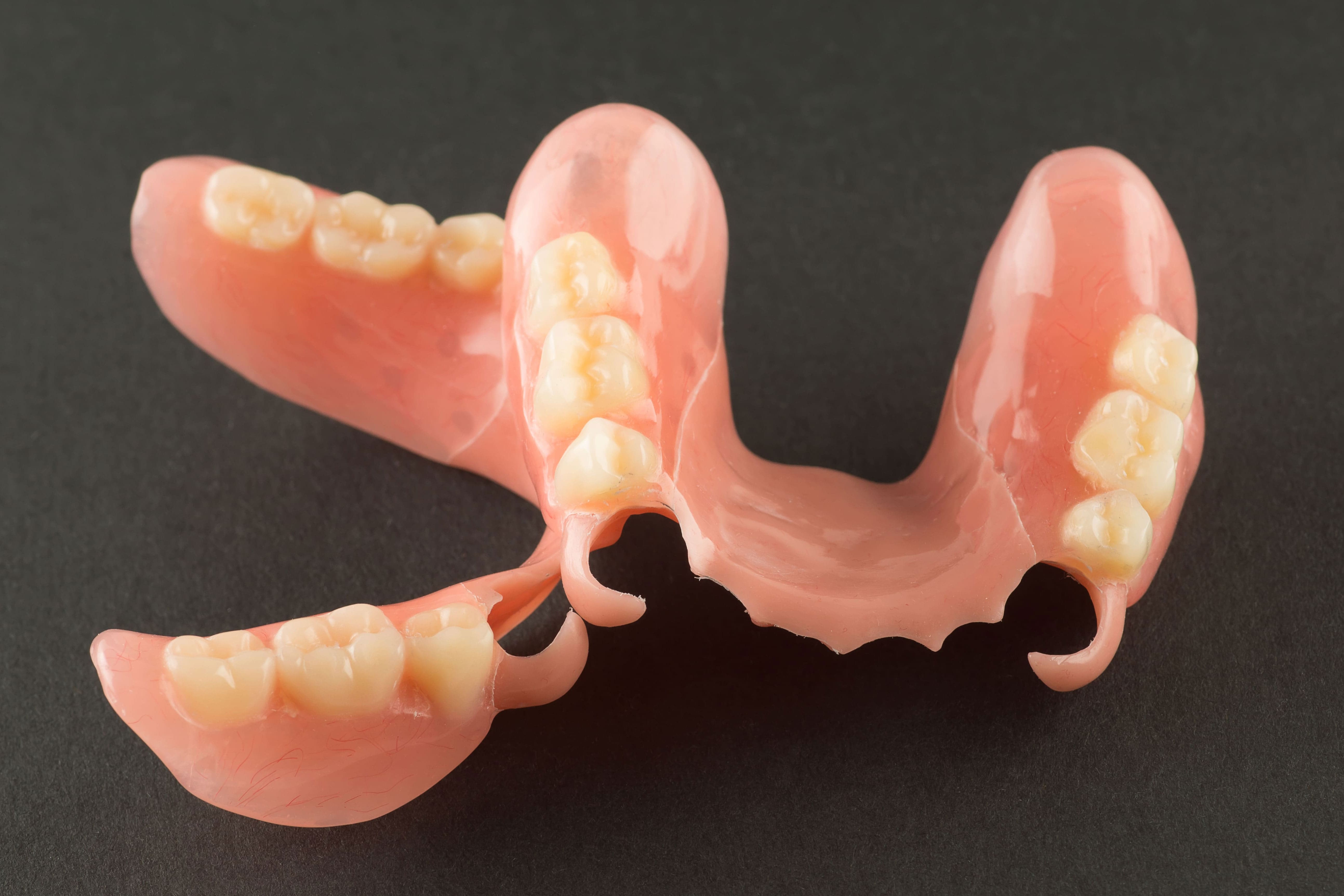 ノンクラスプデンチャー