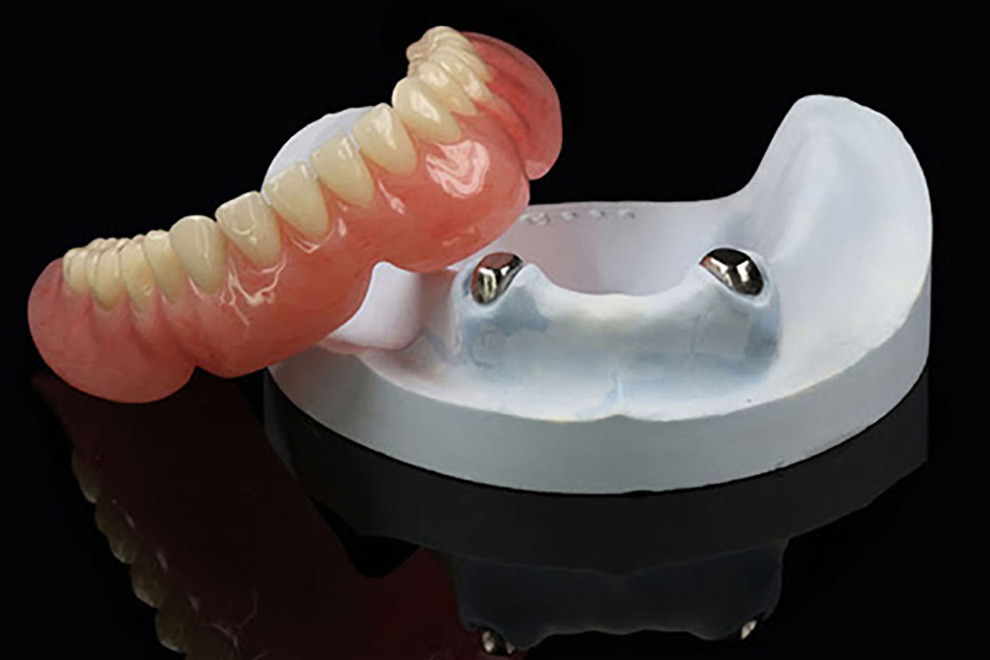 マグネットデンチャー