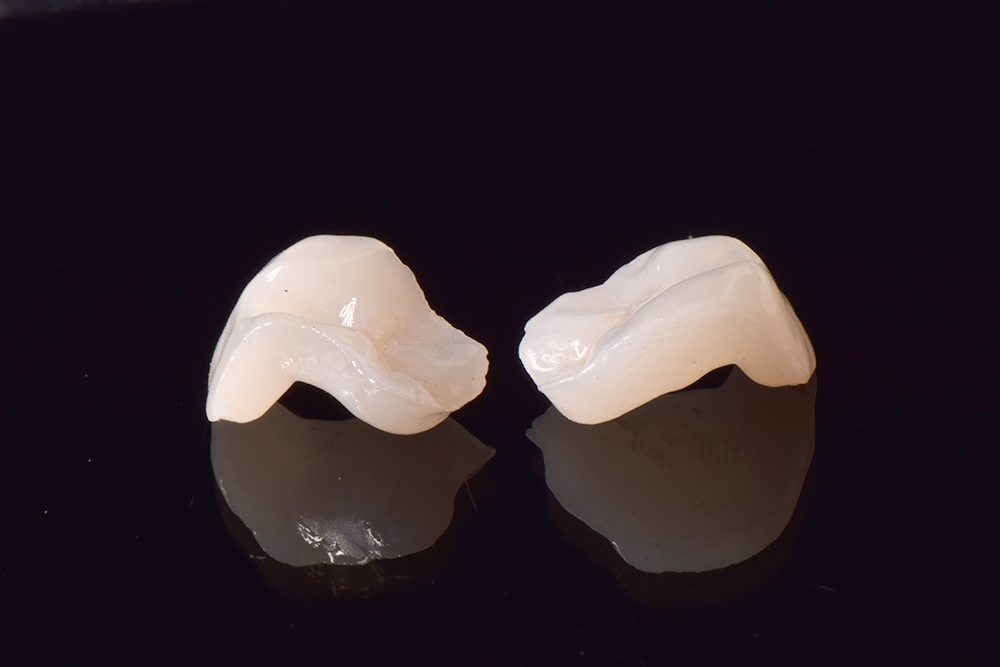 ハイブリッドセラミック