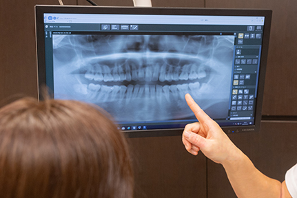 インプラント治療のご相談