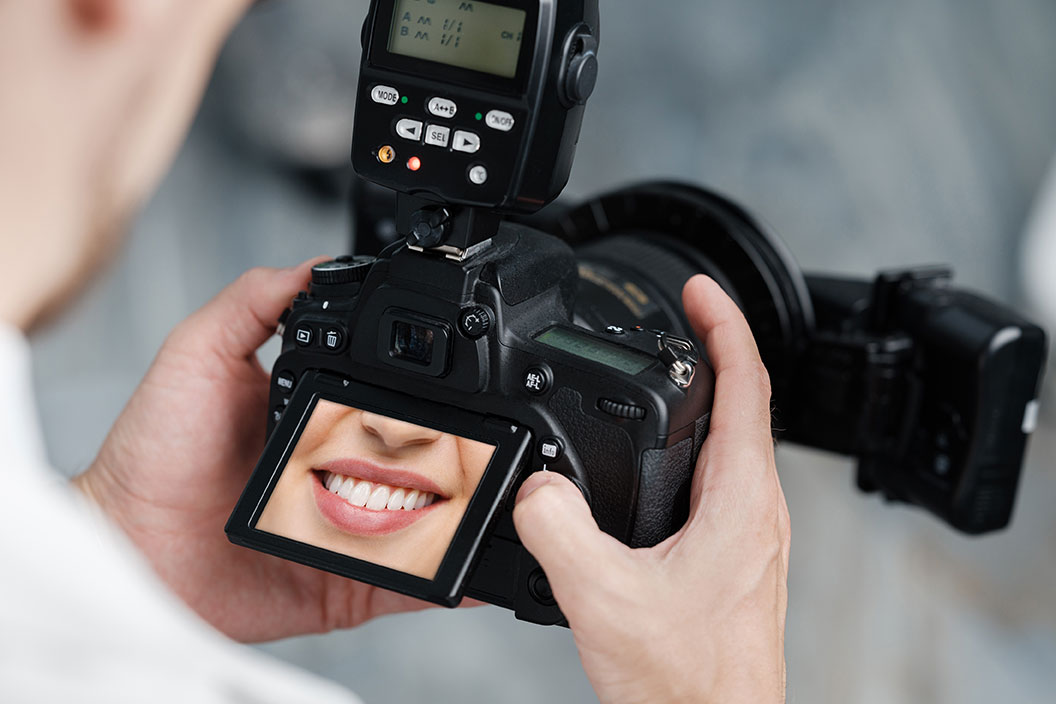 口腔内診査・写真撮影